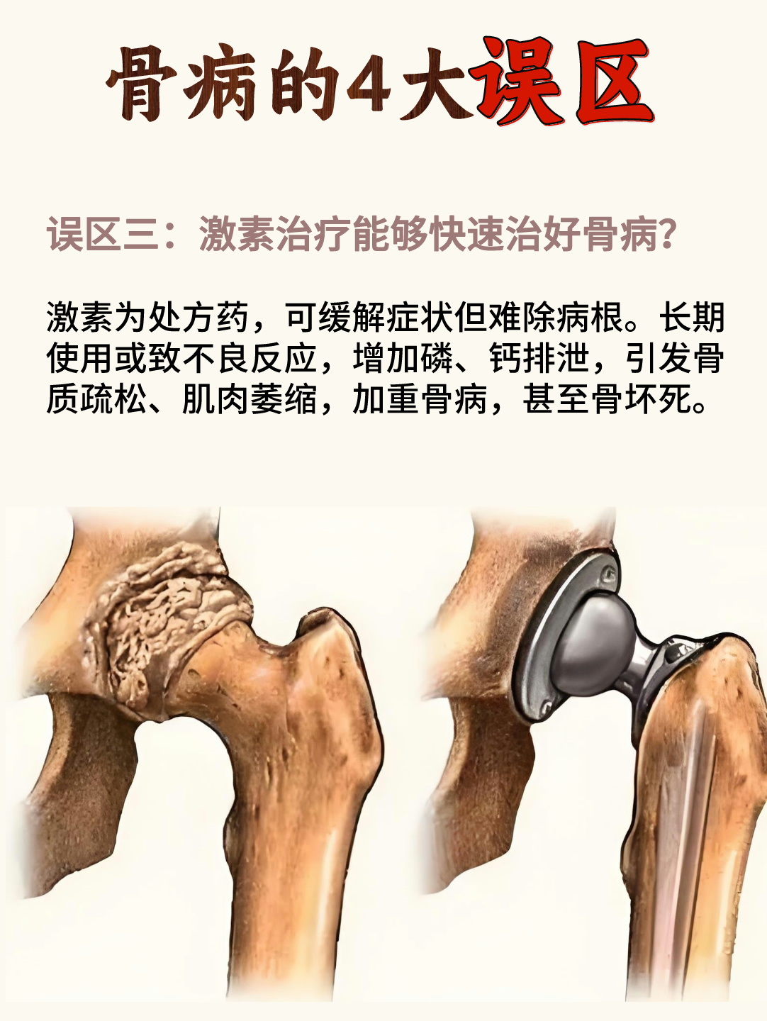 一夜六次疼到让你下不了床一夜六次疼痛经历，无法下床的深刻体验-第1张图片