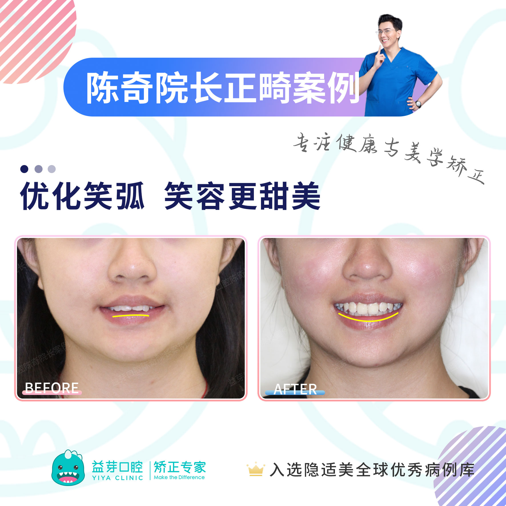 水乳交融和唇齿相依的区别深入解析水乳交融与唇齿相依的微妙区别
