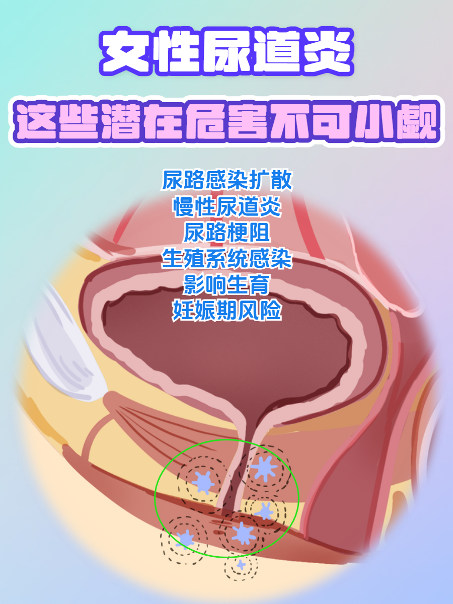 让男人玩尿道的女人探索性爱之谜，让男人玩尿道的女人是如何存在的-第2张图片