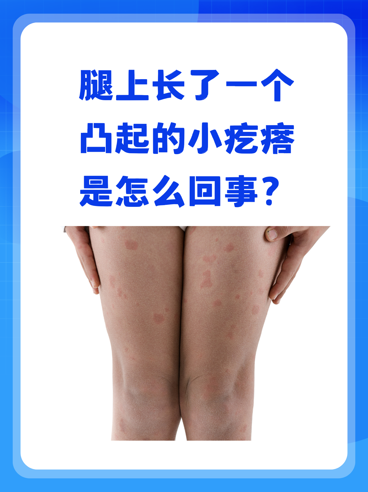 腿抬起来靠墙上就不疼了视频腿抬起来靠墙上就不疼了？一探究竟的视频解析-第2张图片