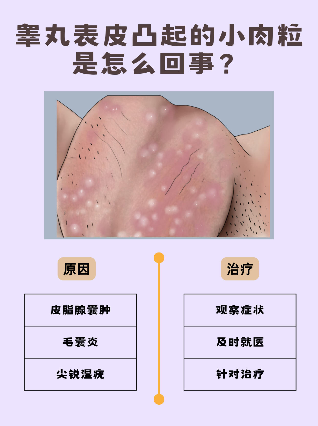 小阴囊唇一边大一边小能自己好吗小阴囊唇一边大一边小，能否自愈？-第2张图片