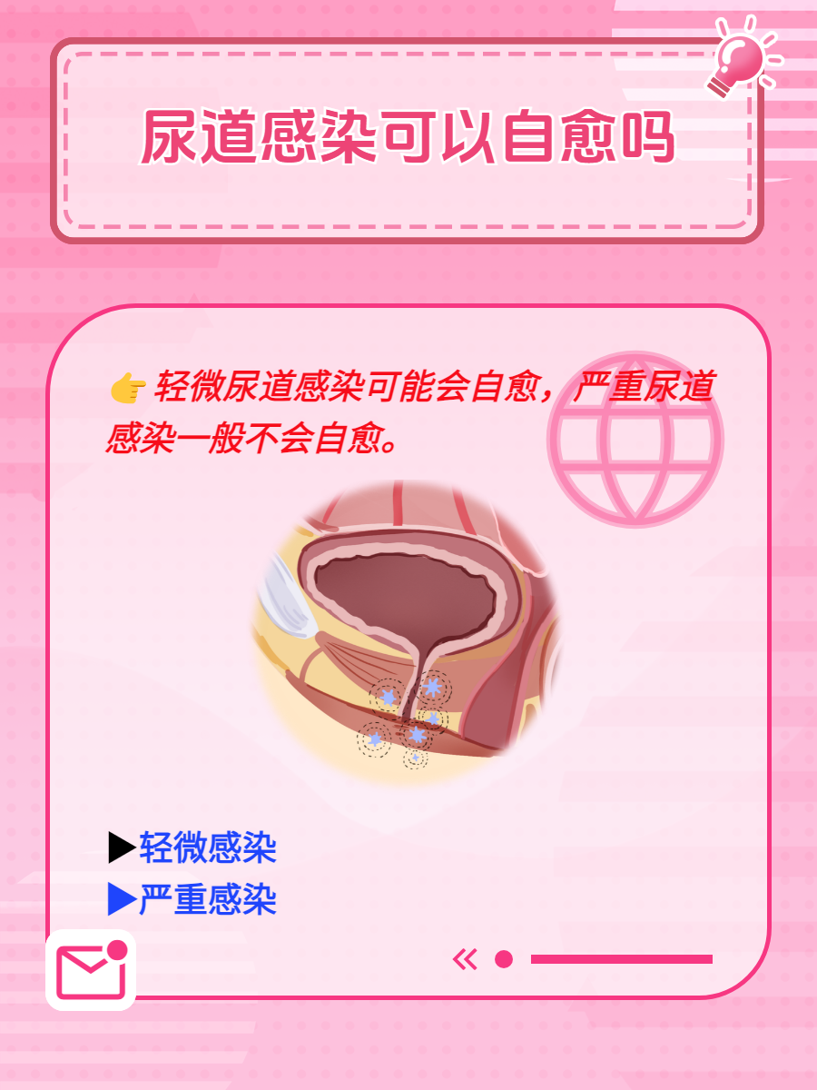 让男人玩尿道的女人探索性爱新领域，让男人玩尿道的女人是如何做到的？-第1张图片