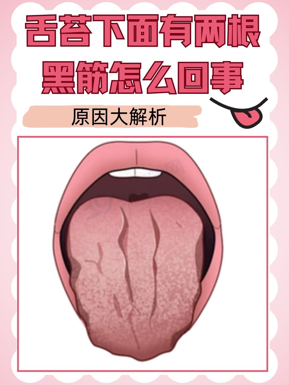 插曲背后的疼痛——30分钟视频中的一卡二卡出血现象解析