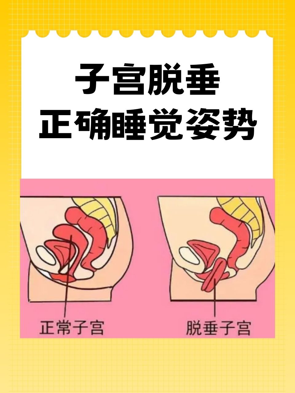 女人睡觉姿势与健康体重的秘密-第2张图片