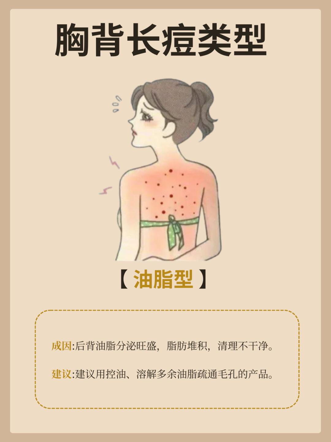 黄色手机视频的危害与防范-第2张图片