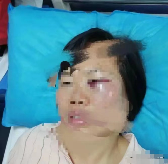 拳头交19分钟拳头交锋的19分钟-第2张图片