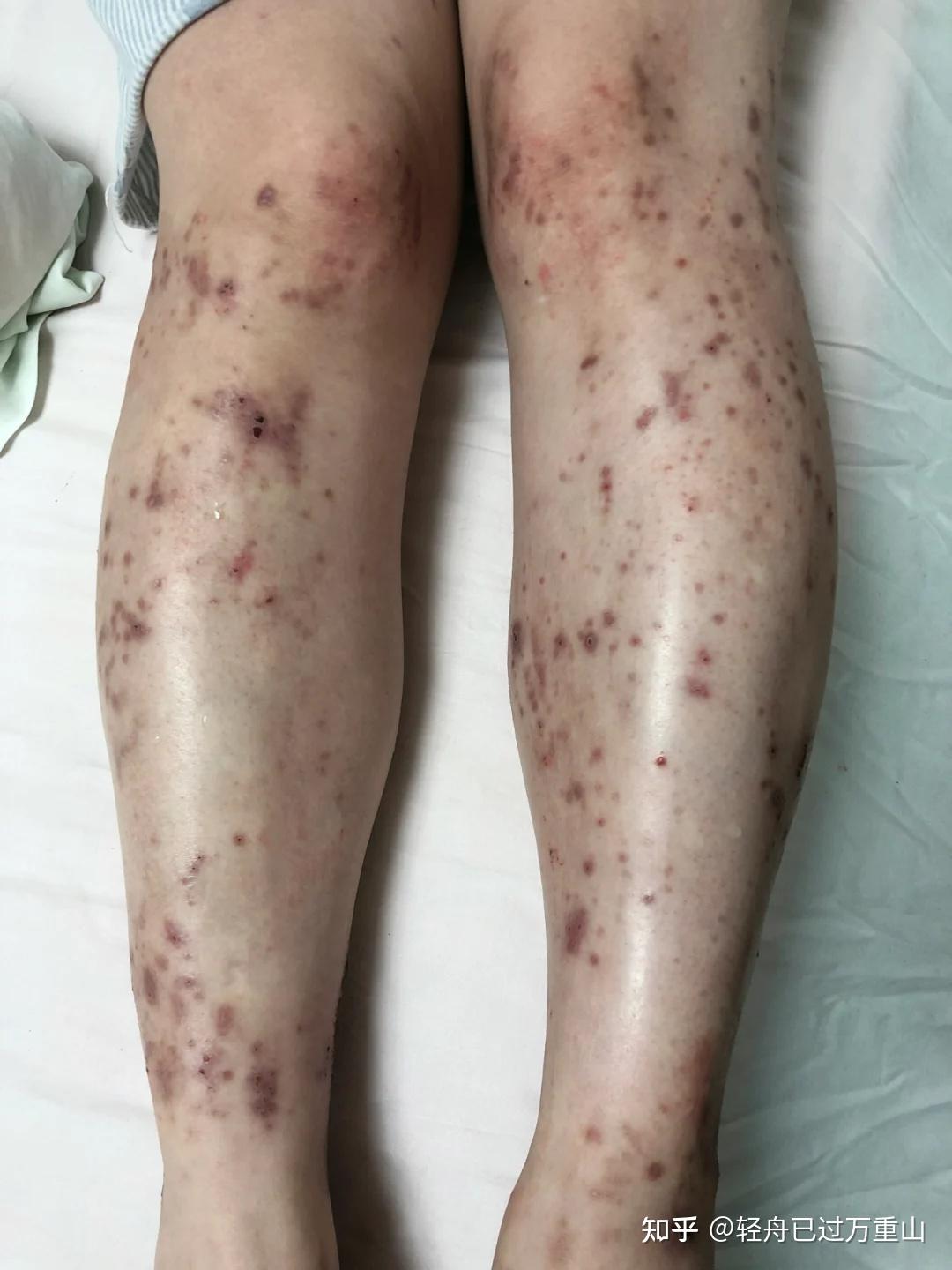 淑芬的微妙困扰，大腿间的痒意-第2张图片