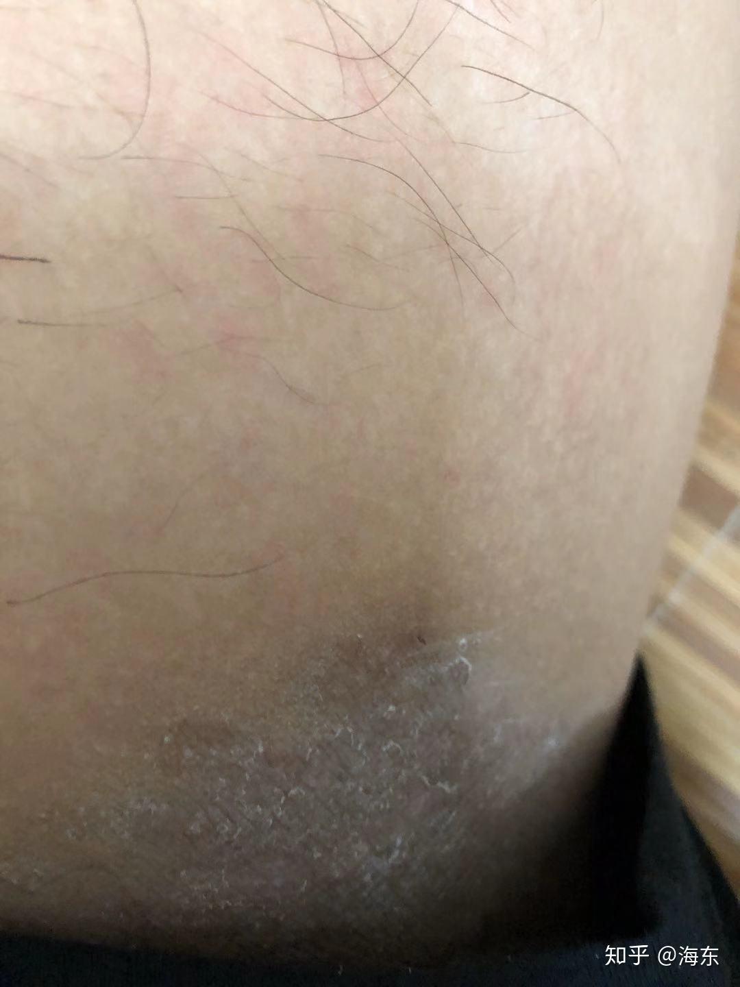 手下滑向大腿内侧小说情节手下滑向大腿内侧的微妙体验