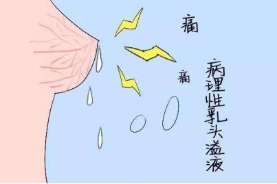 如何弄出很多自己白色液体如何正确理解并处理身体分泌物——以白色液体为例-第2张图片