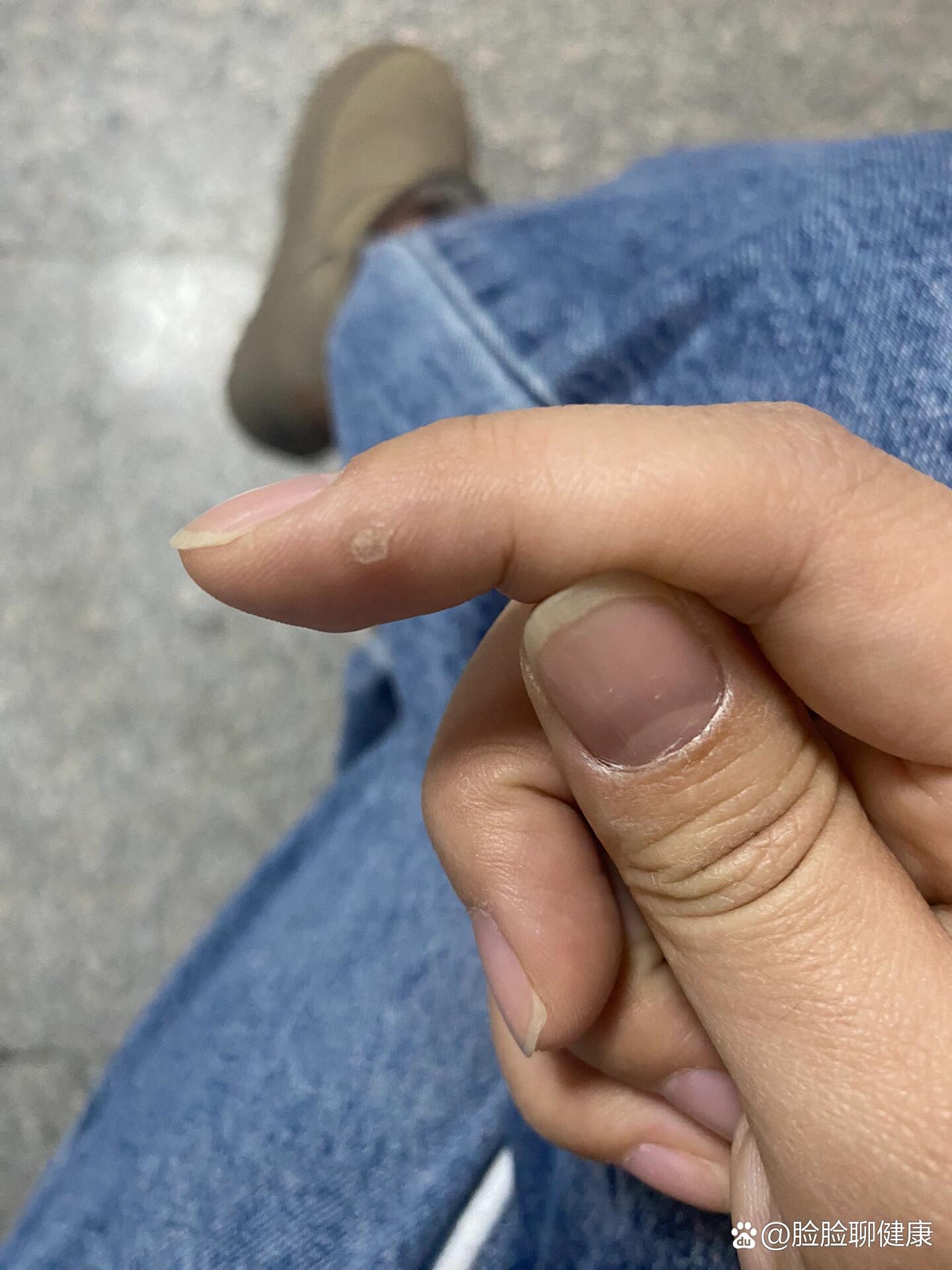 一个手指头就疼成这样视频虐一指之痛，从微小细节看身体疼痛的巨大影响——一个手指头就疼成这样视频的启示-第2张图片