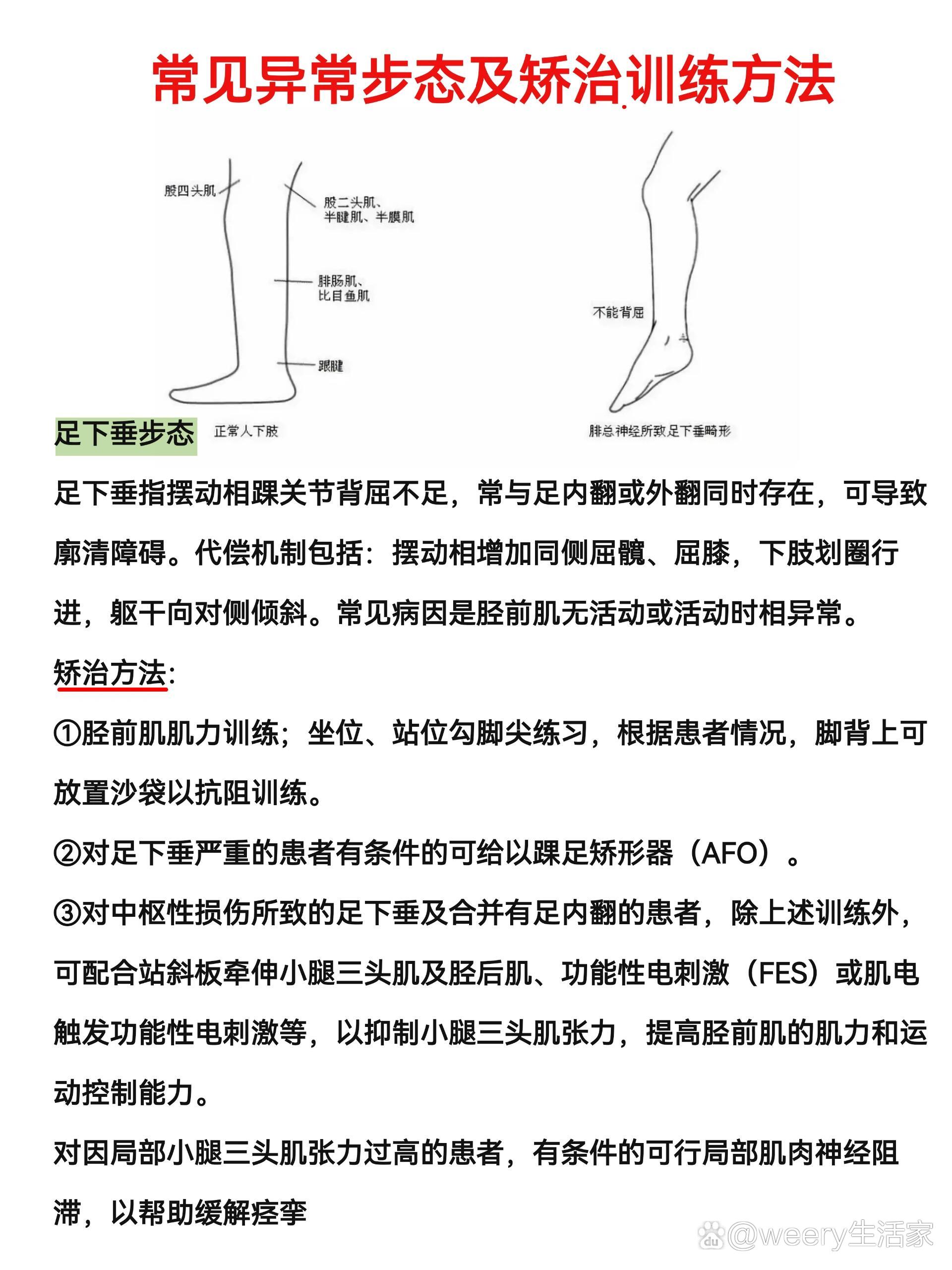 步态蹒跚，行走中的姿态与意义