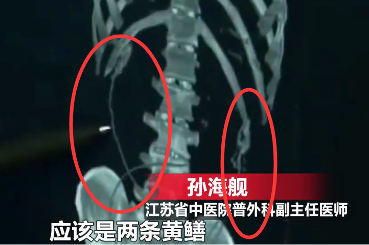 黄鳝门种子，探索其背后的故事与意义-第1张图片