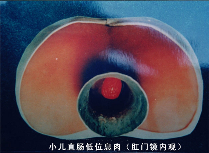 公息肉的魅力，粗大爽快体验的探索