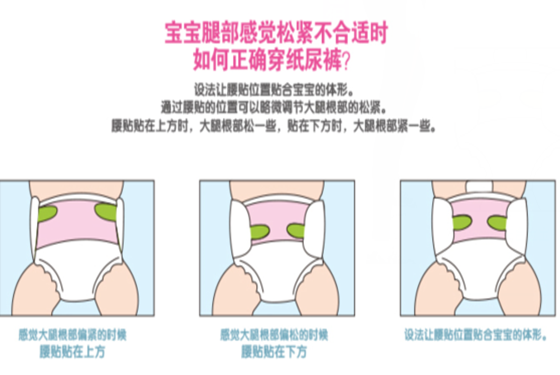 宝宝腿抬起来怎么回事宝宝腿抬起来就不疼了，探索疼痛背后的缓解方法-第3张图片