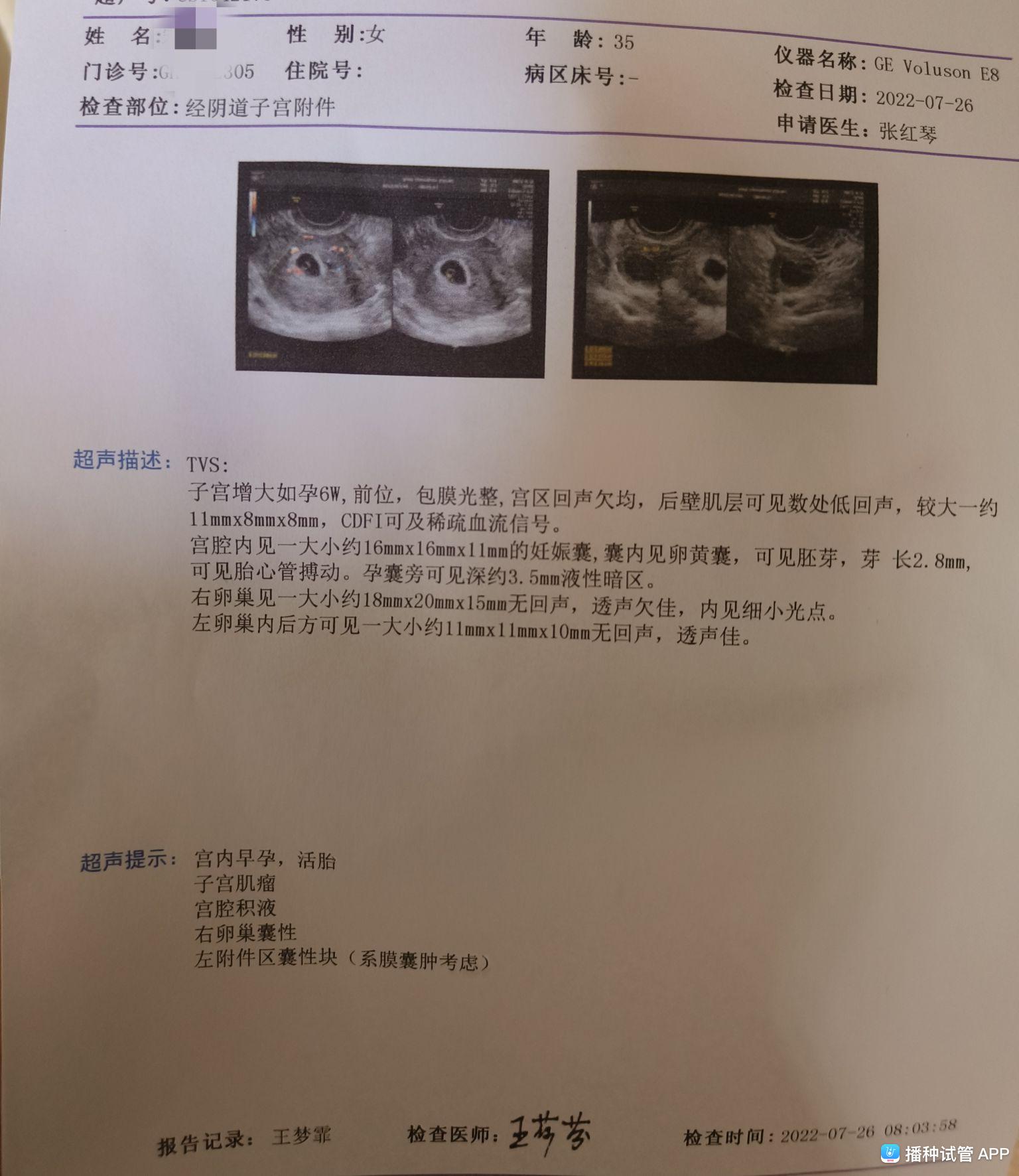ALPHA孕囊顶开 分娩ALPHA孕囊顶开，分娩的神秘之旅-第2张图片