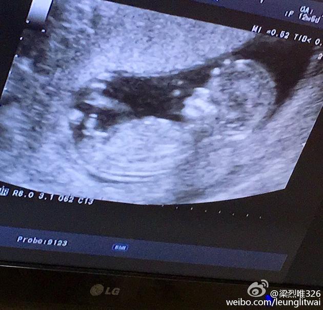 为什么B超越小越舒服免费为何B超越小越能带来舒适与免费的体验？-第2张图片