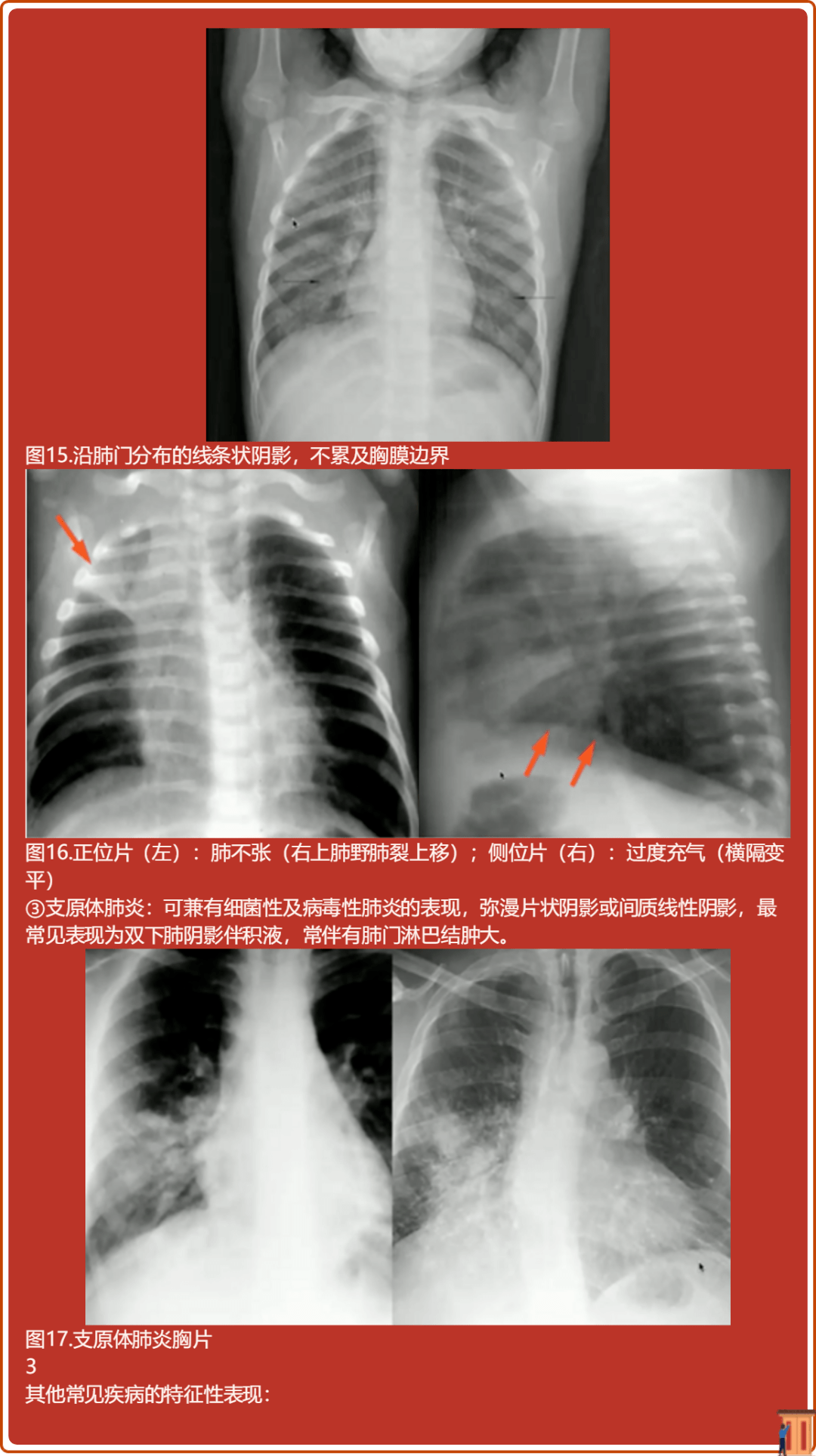 超大胸片曝光图像怎么看超大胸片曝光，透视背后的真相与影响-第1张图片