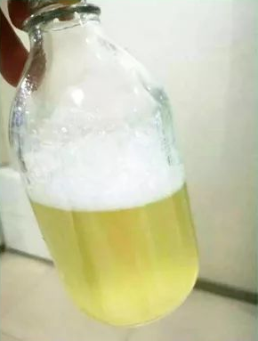 尿在肚子里不能流出来美文小说尿在肚子里不能流出的奇妙体验-第2张图片