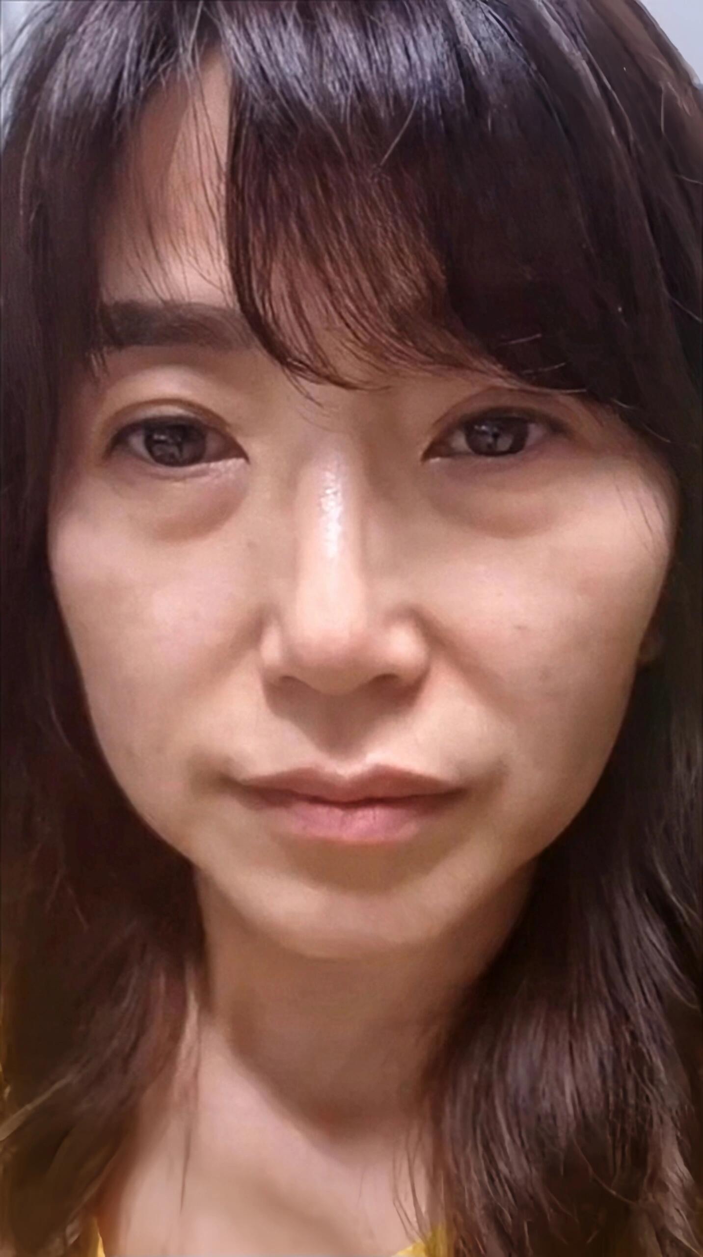 80岁的老太婆松弛怎么办如何应对80岁老太婆的肌肤松弛问题-第2张图片