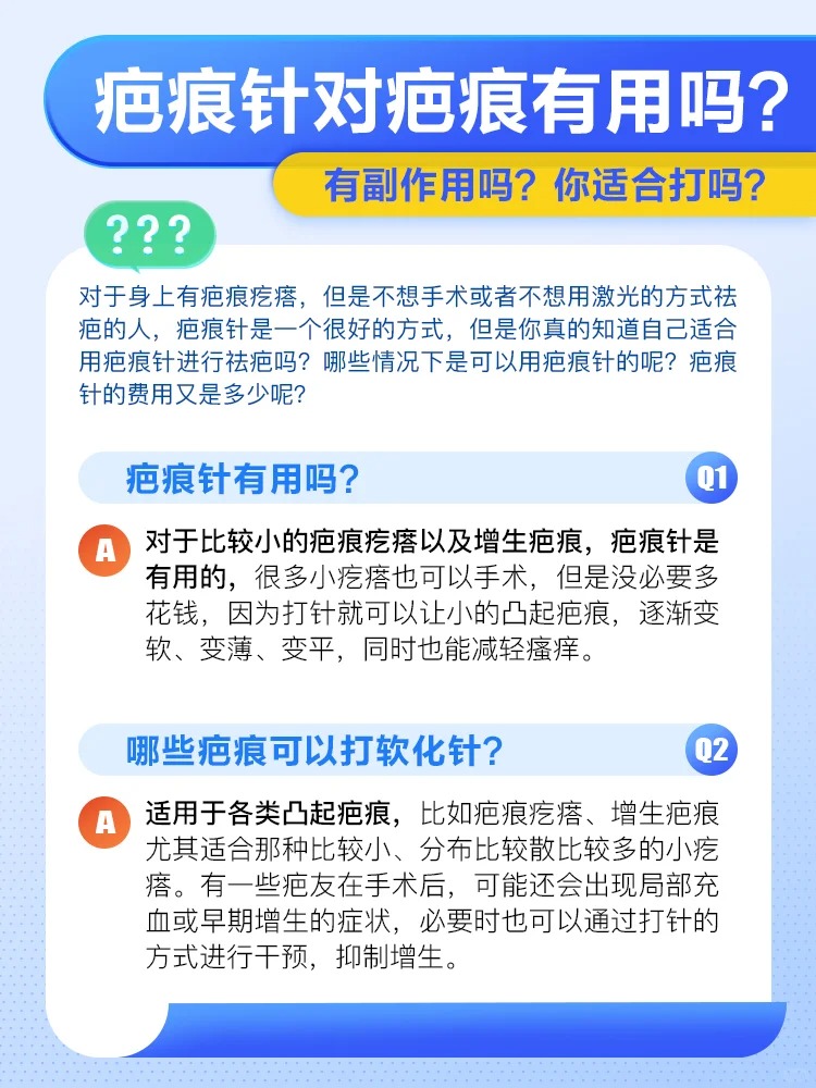 刀疤在哪抓探索未知的刀疤刷新点-第3张图片
