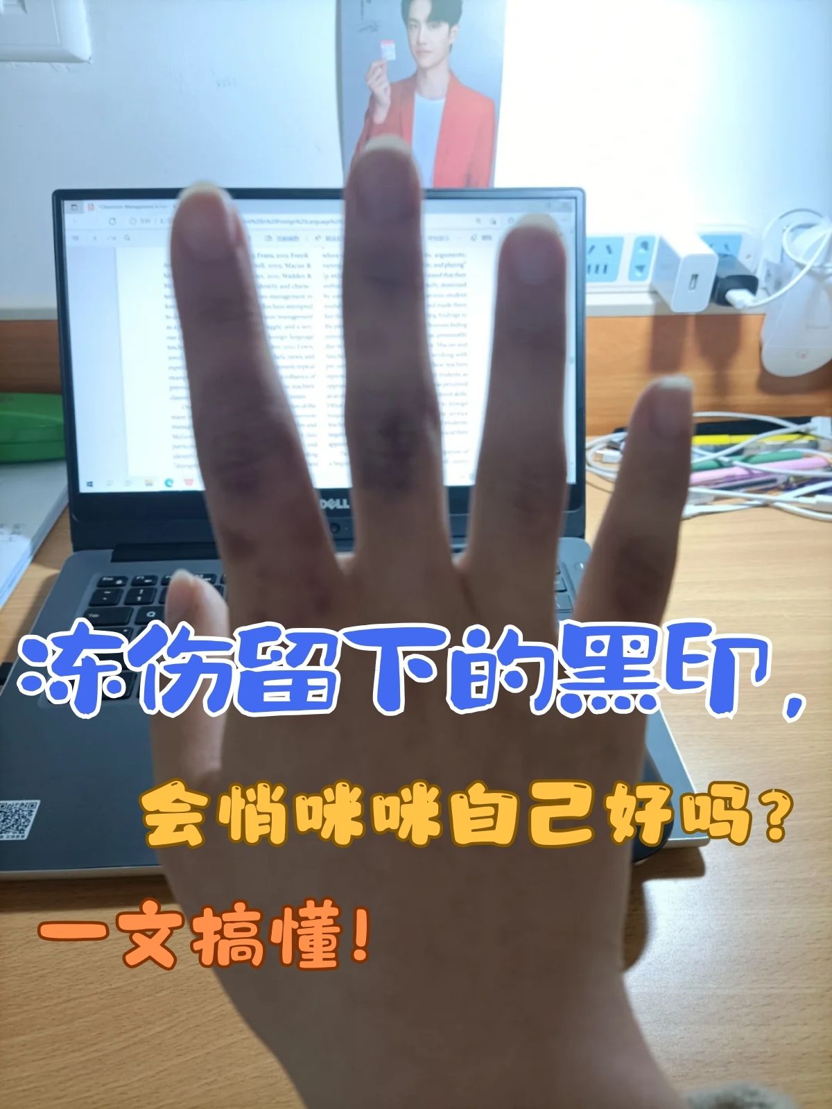 如何应对冻伤与实现自我成就-第2张图片