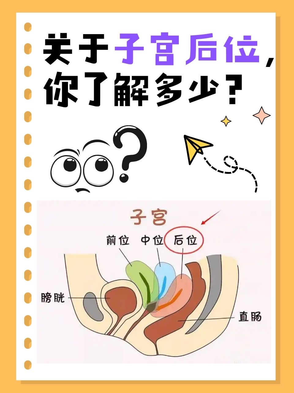 女上男下体位后左下腹疼痛的医学解析