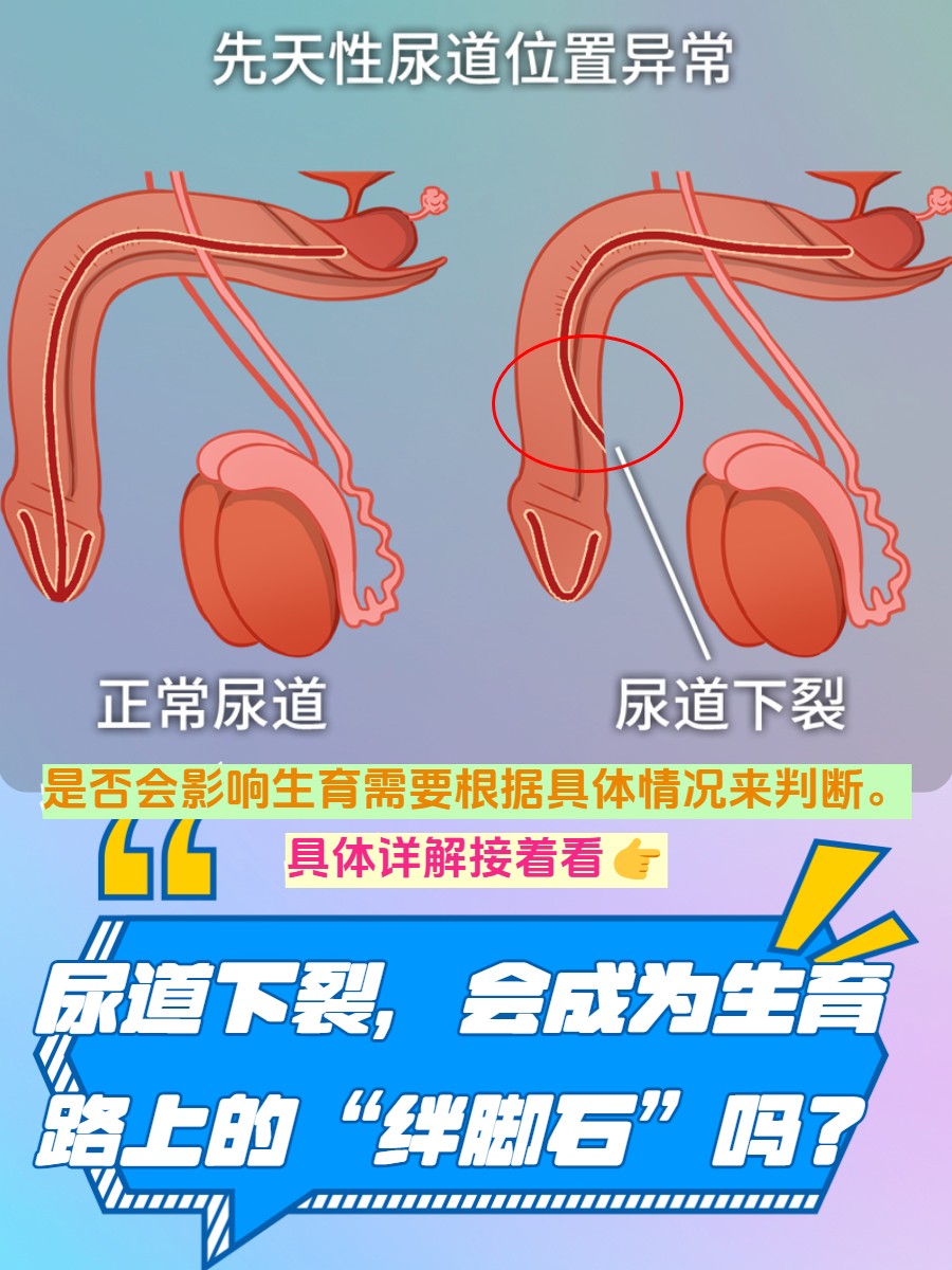 WRITE AS 尿道口尿道口的生理结构与WRITE AS的医学应用-第2张图片