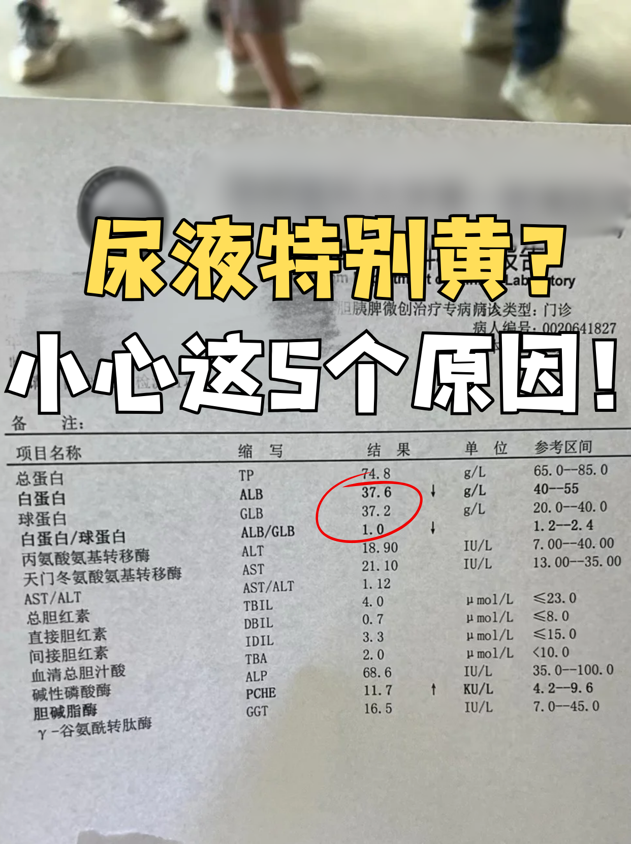 WRITE AS 尿液尿液的神秘面纱，从科学角度解读WRITE AS 尿液