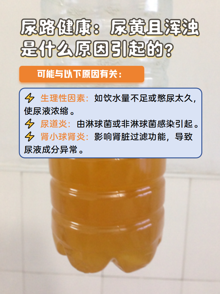 关于厕所撒尿的生理现象与女性尿流特征探讨