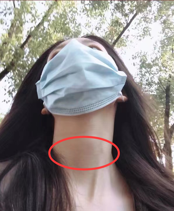医生与患者之间的误解——一次不恰当的触诊经历-第2张图片