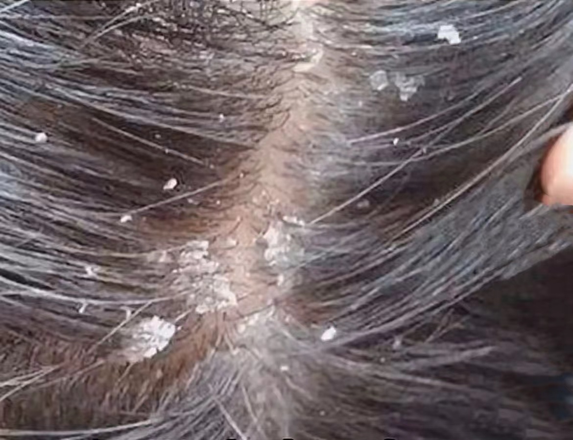 下面一阵一阵的流水怎么回事女生如何通过自我调节提升皮肤状态