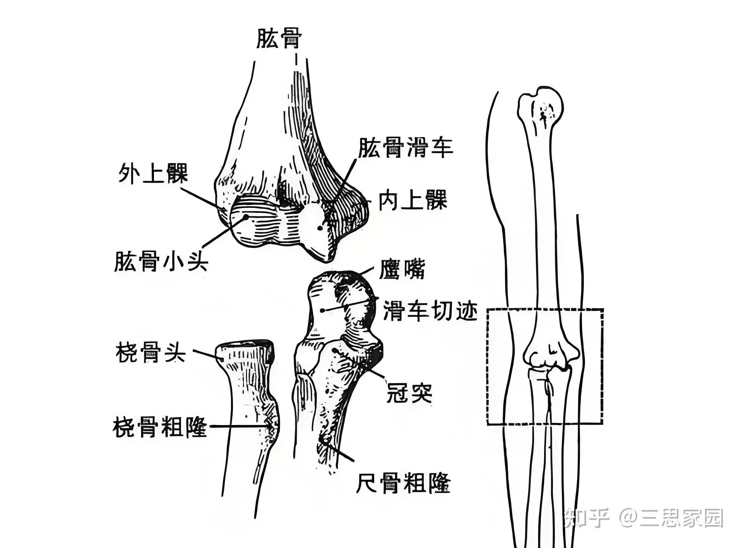 蝴蝶臂是什么原因造成的蝴蝶臂之美，探索与理解-第1张图片
