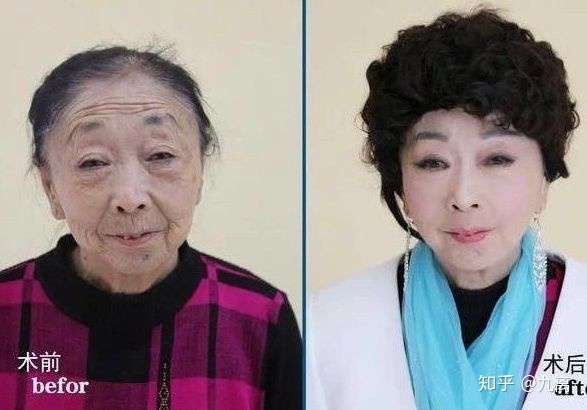 性XXXX60老太婆性健康与老年女性的生活——以60岁老太婆为例-第3张图片