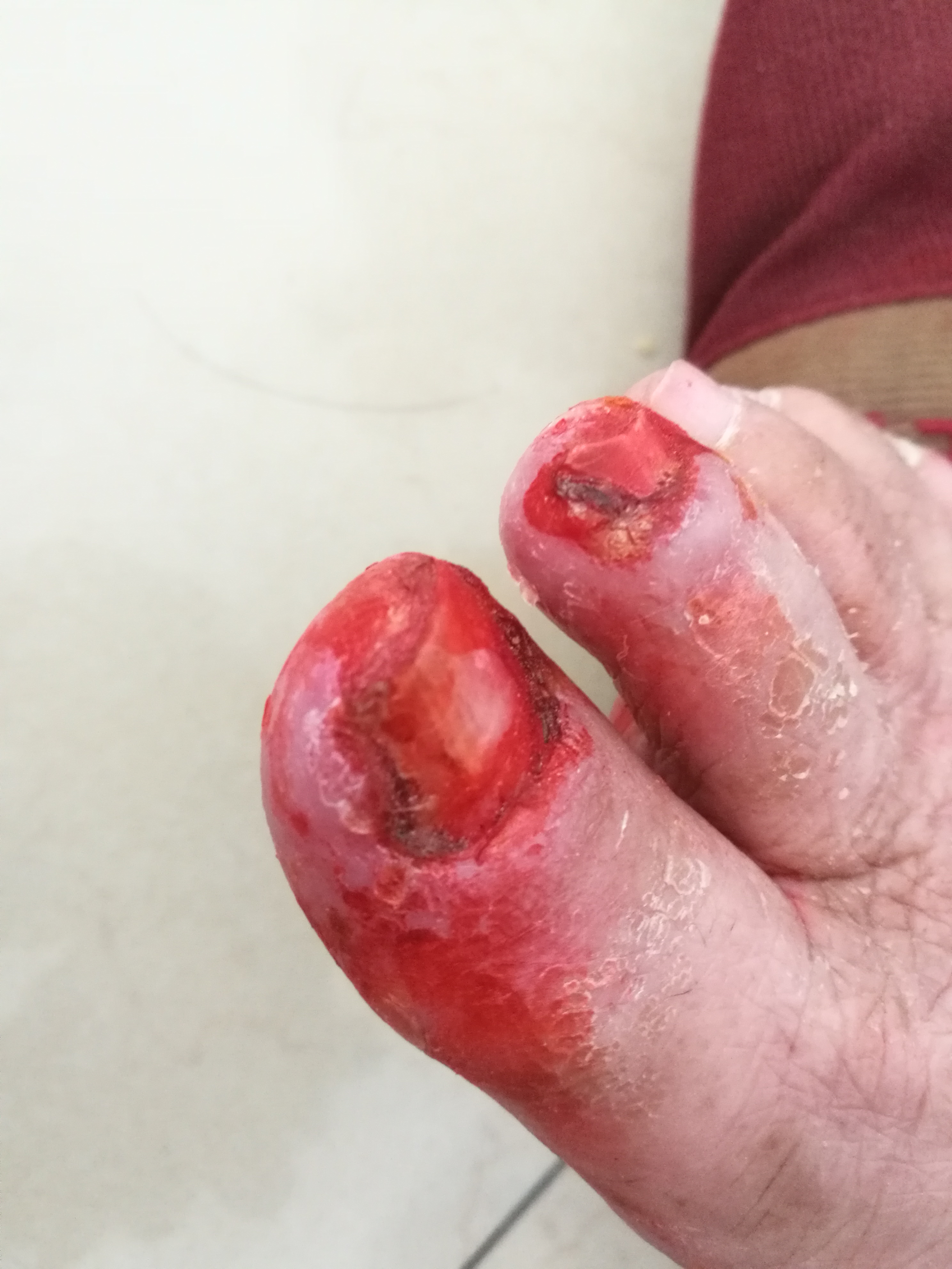 关于涂药后遭遇群体性侵犯的悲剧