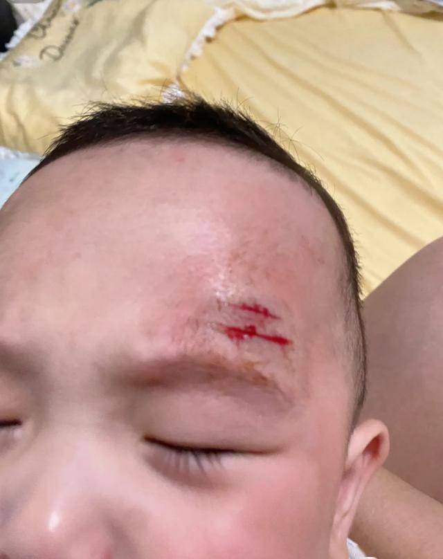 宝宝自己摔倒怎么才算是没事的宝宝是意外撞入还是自主坐下？-第2张图片