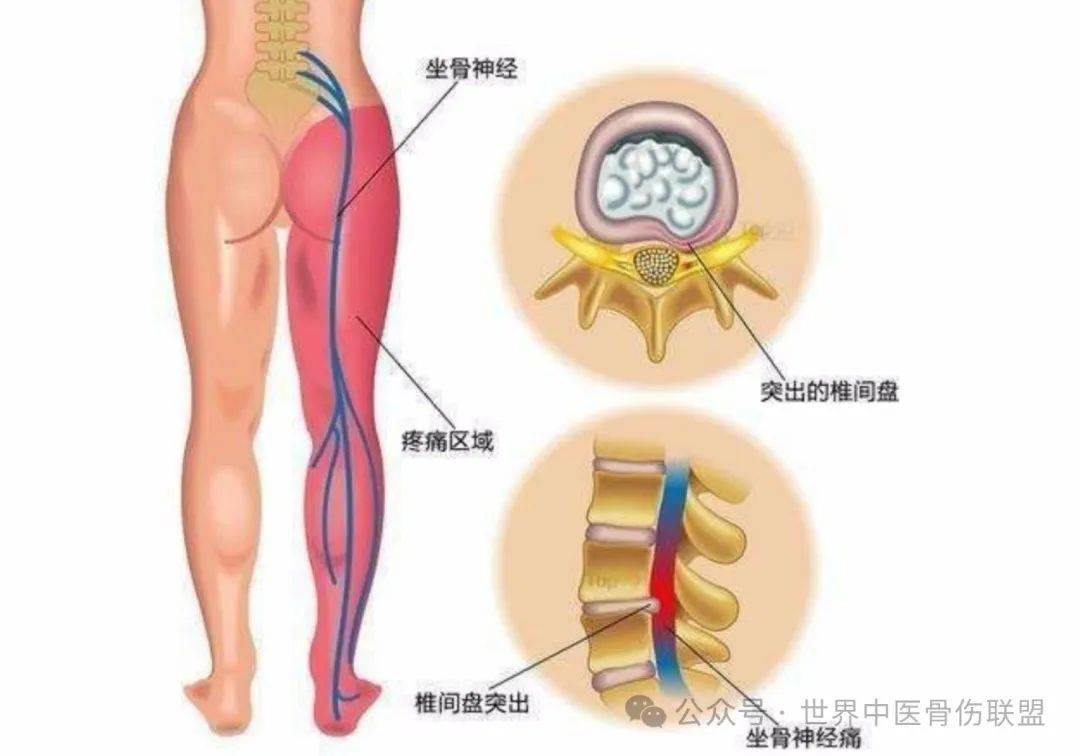 三根同插之痛-第2张图片