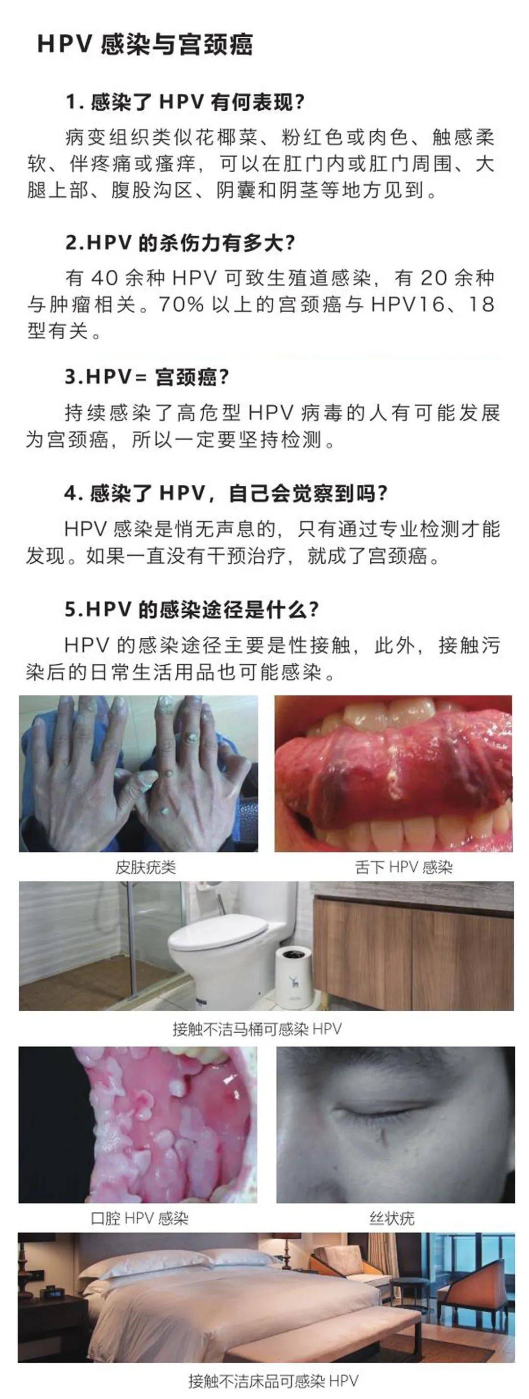 生殖器勃起图片关于生殖器勃起图片的探讨（需谨慎对待）-第2张图片