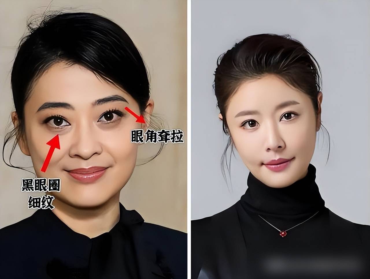 上边的面与下边的面相比结果是什么上边一面亲，下边一面膜——现代生活中的双重体验