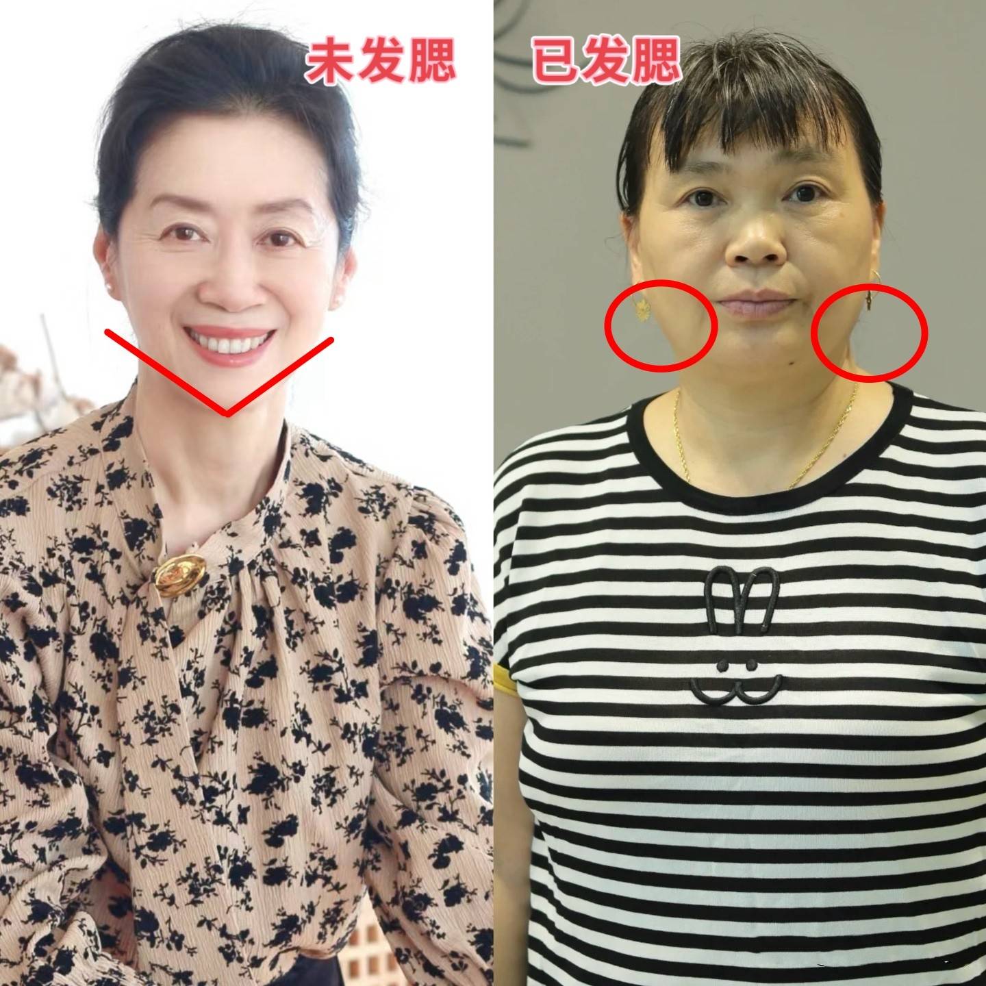 老女人性痒的困扰与应对策略