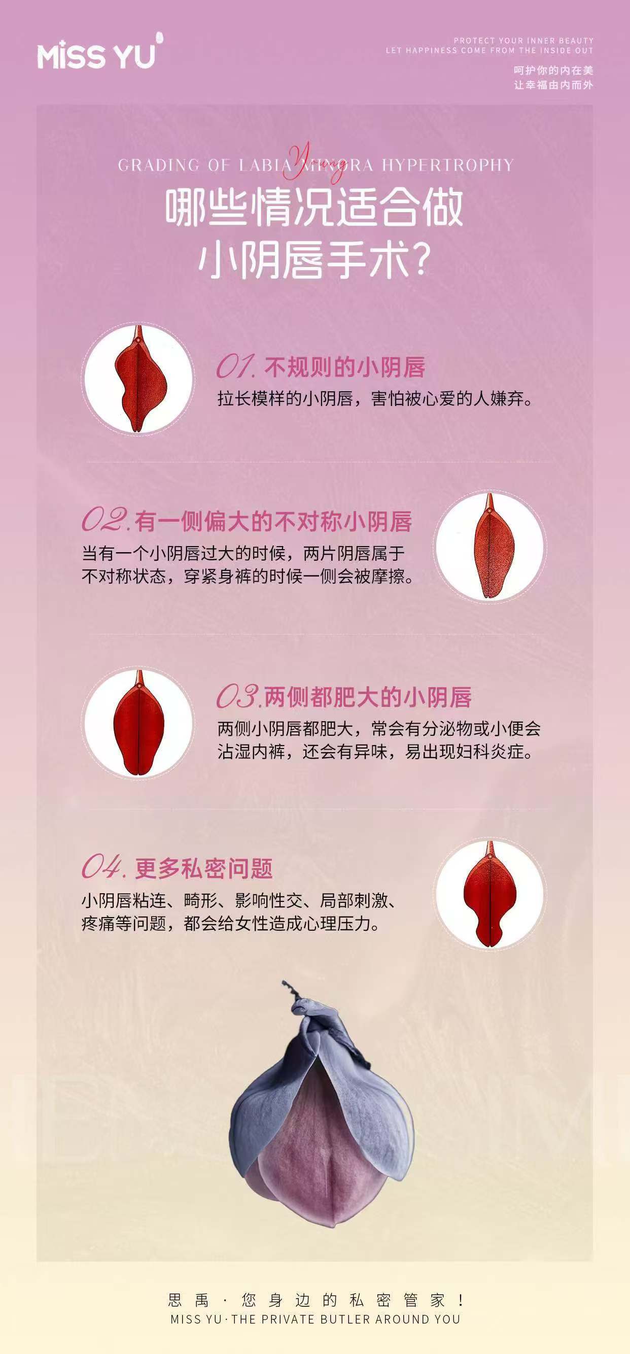 小阴囊唇一边大一边小能自己好吗小阴囊唇一边大一边小，能否自愈？-第3张图片
