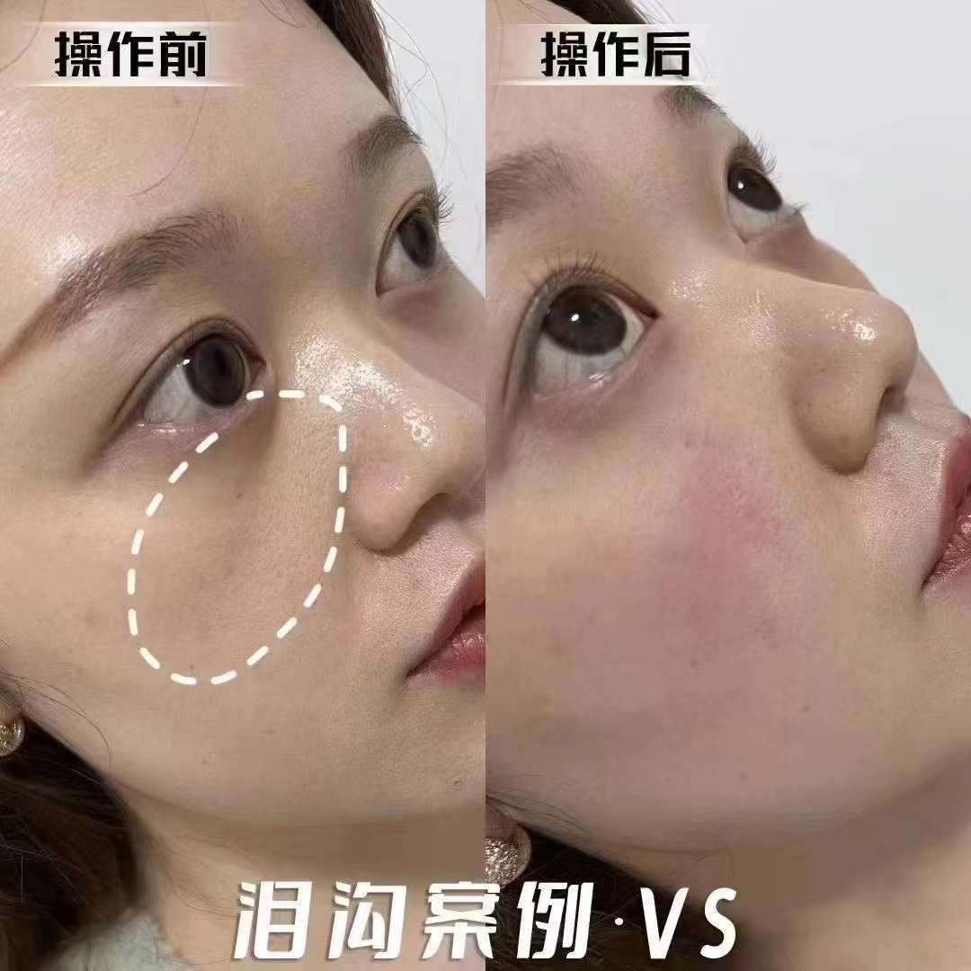 小东西的微妙变化——几天未做后的紧致体验-第3张图片