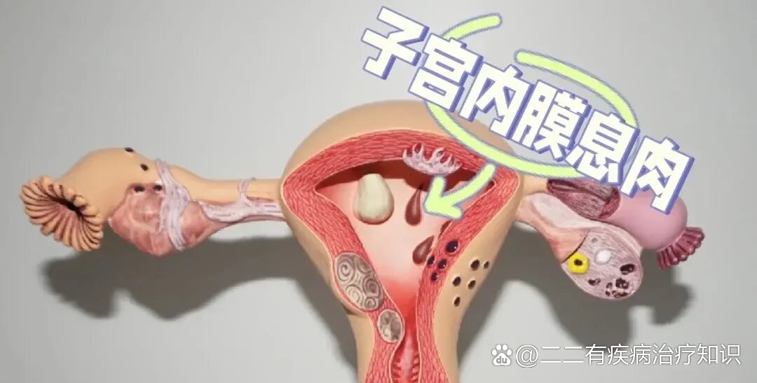 公息肉秀婷的28天短篇故事-第2张图片