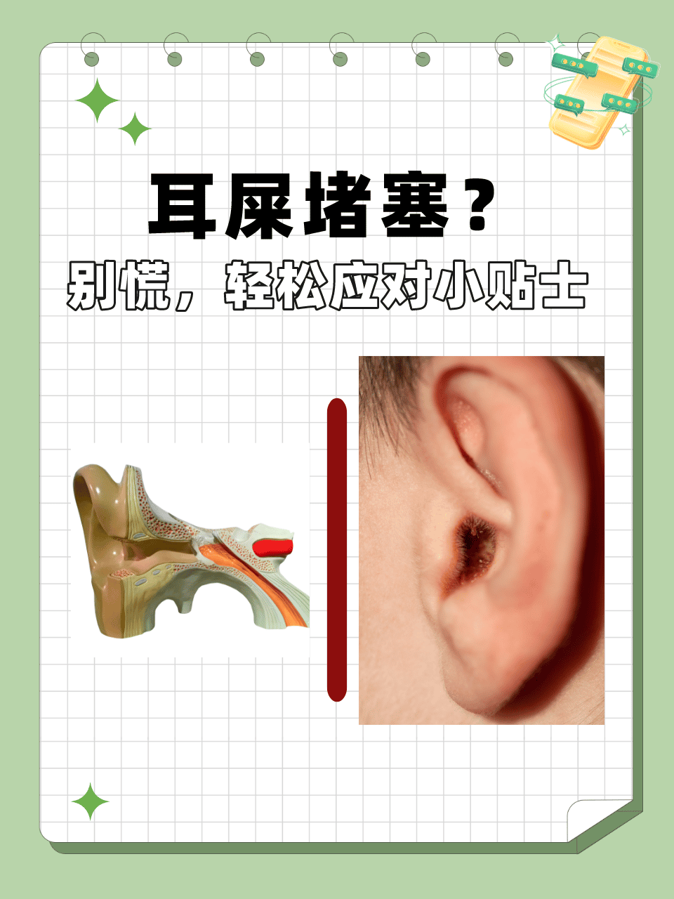 巧妙运用塞子，堵住液体之流-第1张图片