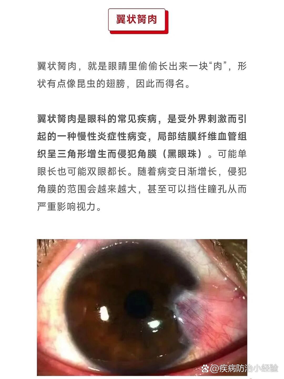 超级胬肉系统小说第二部，新征程的启航