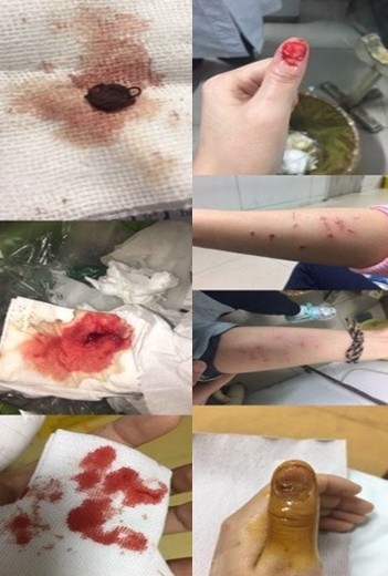 掀衣抓下体女性事件关于掀衣抓下体女性事件的深度分析与思考-第1张图片