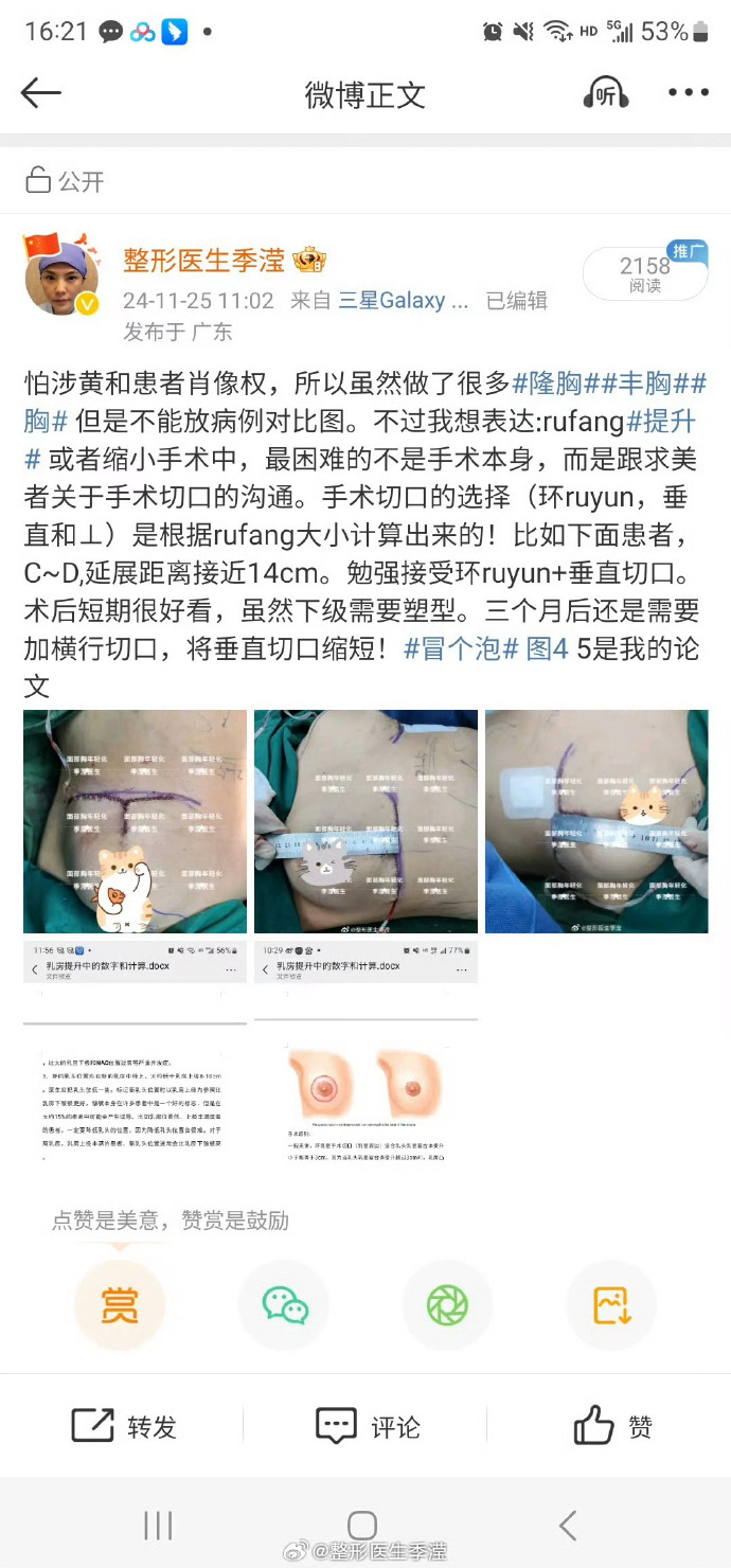 用嘴来丰胸用嘴来丰胸，一个荒谬的传说还是真实的奇迹？