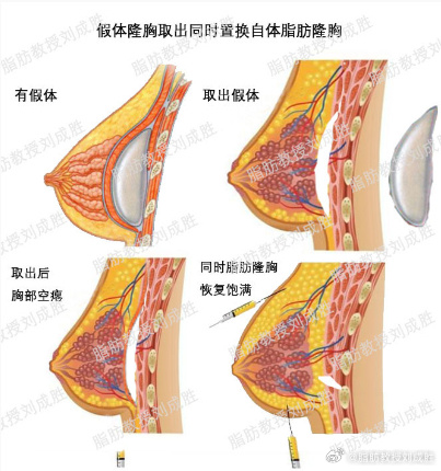 探索女性之美，胸前两团巨大乳球的魅力