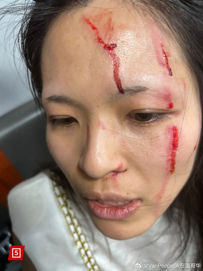 我要打飞华人永久免费我要打飞华人——一个错误的观念与呼吁