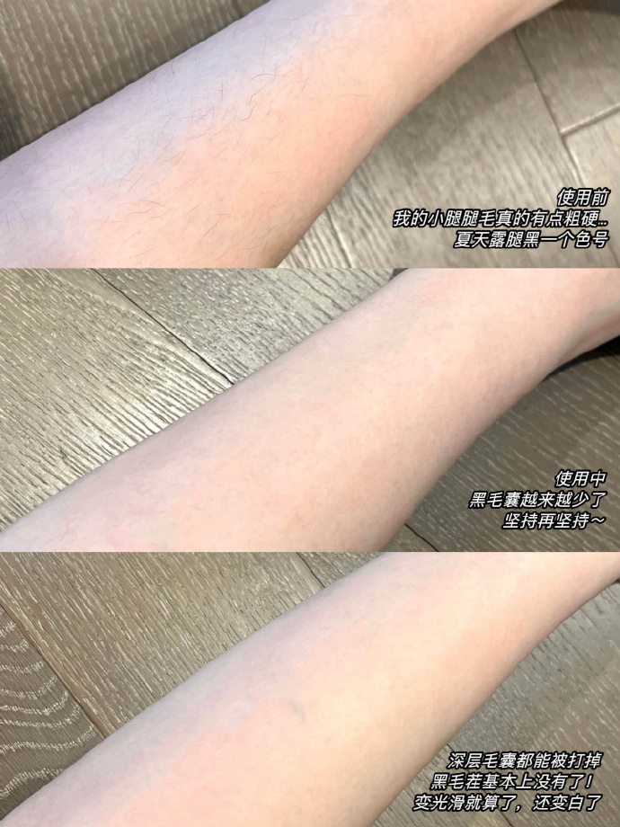 美女的脱毛之道