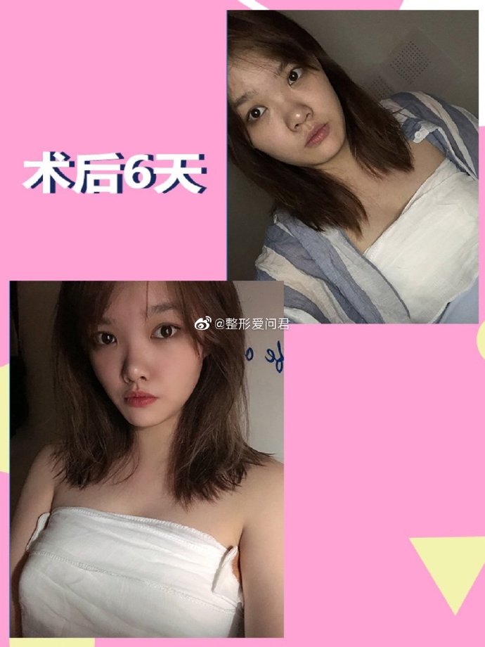 贫乳大赛贫乳大赛，一次关于自信与美丽的探索